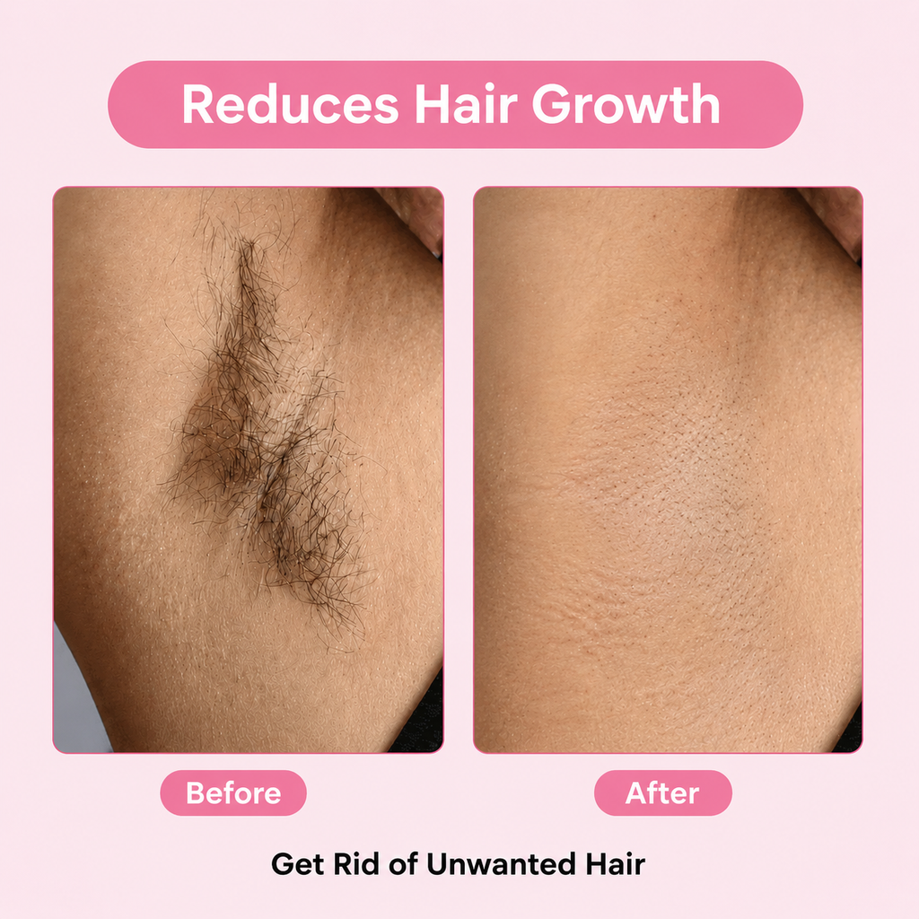 Cyperus Rotundus Oil for Hair Reduction